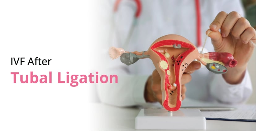 IVF After Tubal Ligation: Success Rates & Steps
